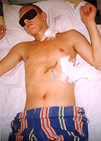 Статьи о ножах и не только articles_after_knife_fight_3
