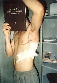 Статьи о ножах и не только articles_after_knife_fight_5