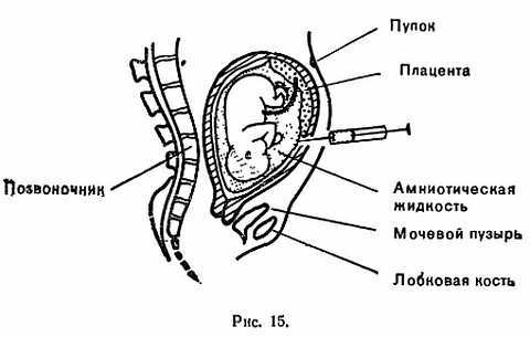Знайте свои гены _19.jpg