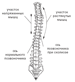Массаж при заболеваниях опорно-двигательного аппарата pic_8.png