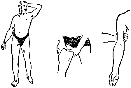 Умей оказать первую помощь any2fbimgloader4.png