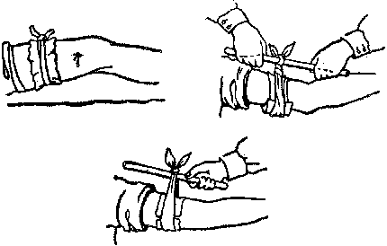 Умей оказать первую помощь any2fbimgloader5.png