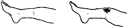 Умей оказать первую помощь any2fbimgloader7.png