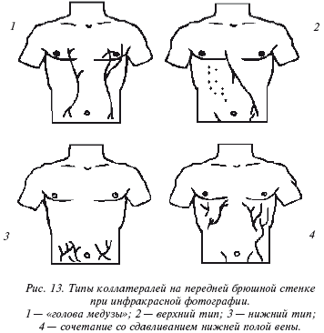 Очищение организма и здоровье: современный подход i_013.png