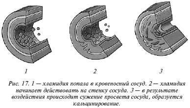 Очищение организма и здоровье: современный подход i_017.png