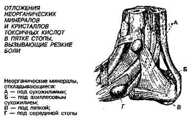 Шокирующая правда о воде и соли any2fbimgloader39.jpeg