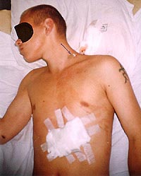 Статьи articles_after_knife_fight_2