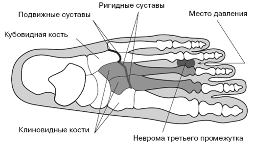 Все о здоровье ваших ног. От младенчества до старости pic_8.png