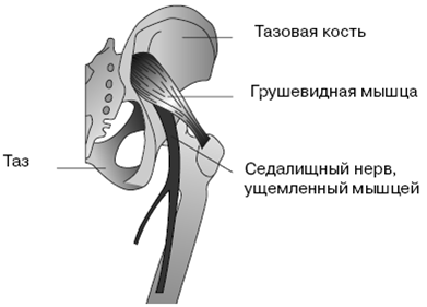 Все о здоровье ваших ног. От младенчества до старости pic_17.png