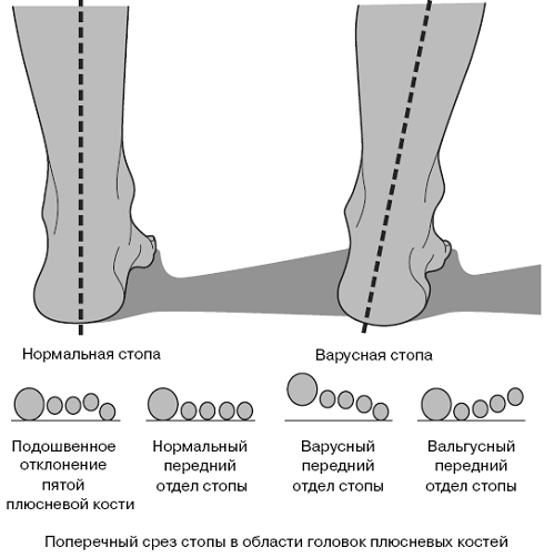 Все о здоровье ваших ног. От младенчества до старости pic_6.png