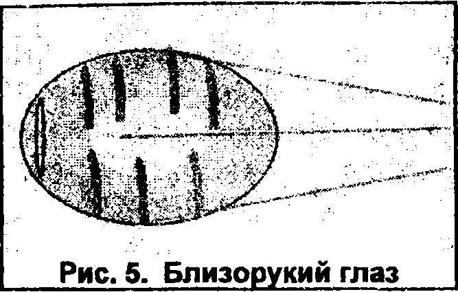 Восстановление зрения img_6.png