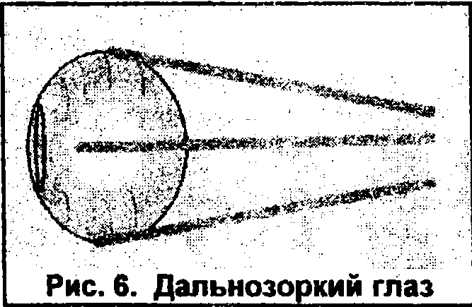 Восстановление зрения img_7.png