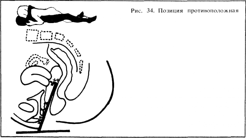 Искусство любви _38.png