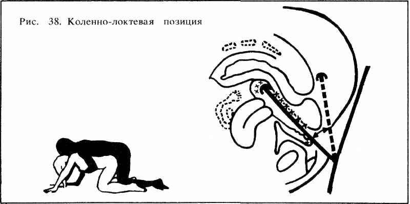 Искусство любви _41.png_0.png