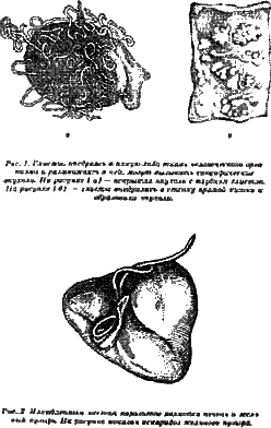 Жизнь без паразитов i01.png
