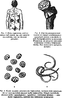 Жизнь без паразитов i02.png