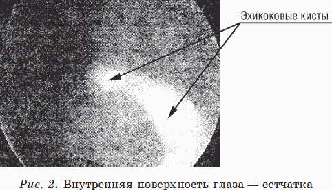 Новые тайны нераспознанных диагнозов. Книга 2 _05.png