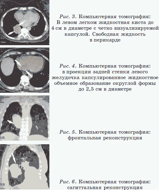 Новые тайны нераспознанных диагнозов. Книга 2 _06.png
