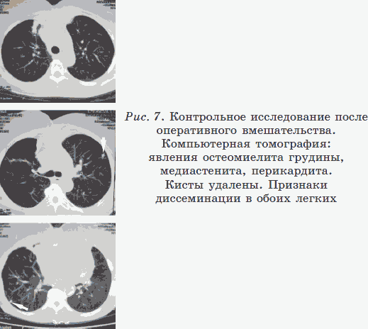 Новые тайны нераспознанных диагнозов. Книга 2 _07.png