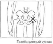Управление телом по методу Пилатеса any2fbimgloader29.jpeg