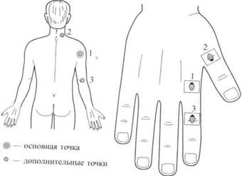 Су Джок семянотерапия any2fbimgloader116.jpeg