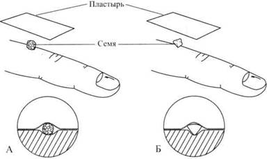Су Джок семянотерапия any2fbimgloader33.jpeg