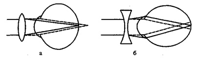 Клинические лекции по офтальмологии image03.png