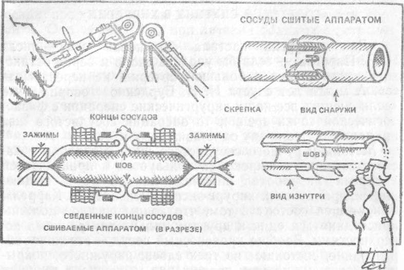 Хирургия без чудес. Очерки, воспоминания img_38.jpg