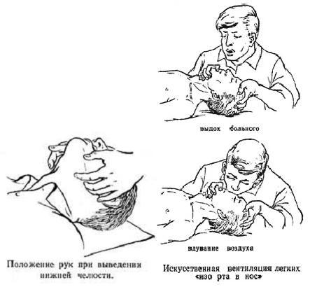 Курс лекций по реаниматологии и интенсивной терапии _3.jpg