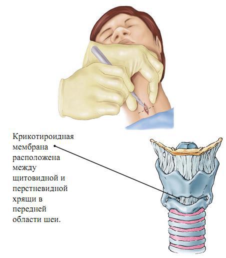 Курс лекций по реаниматологии и интенсивной терапии _4.jpg
