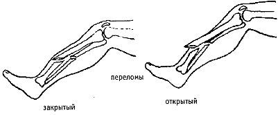 Стиль спецназа. Система боевого выживания _42.jpg