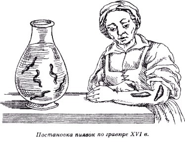 Секреты гирудотерапии i_019.jpg