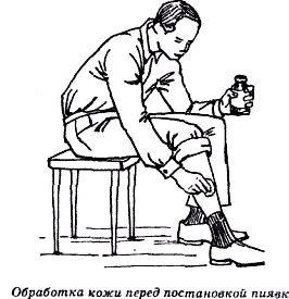 Секреты гирудотерапии i_039.jpg
