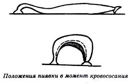 Секреты гирудотерапии i_046.jpg