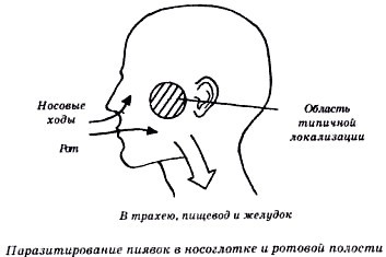 Секреты гирудотерапии i_060.jpg