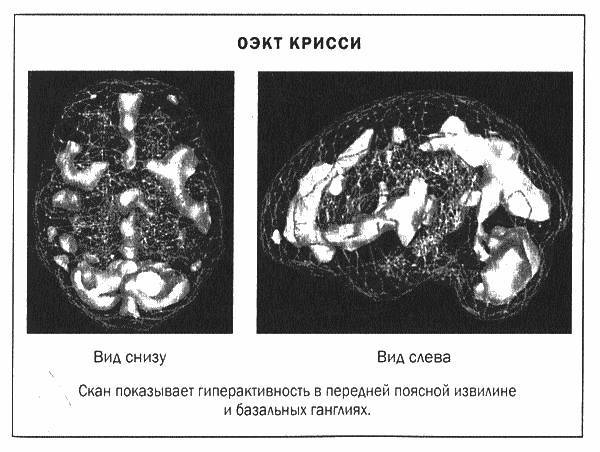 Мозг и душа _14.jpg