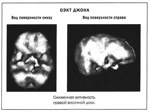 Мозг и душа _18.jpg