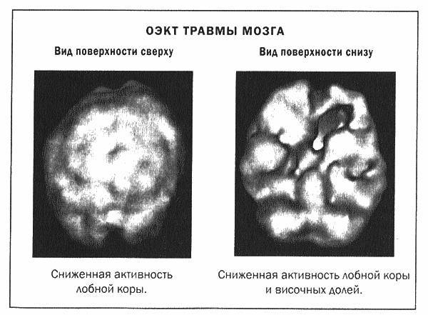 Мозг и душа _19.jpg