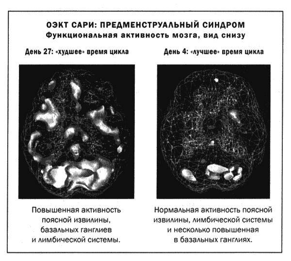 Мозг и душа _42.jpg