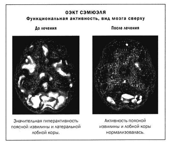 Мозг и душа _43.jpg