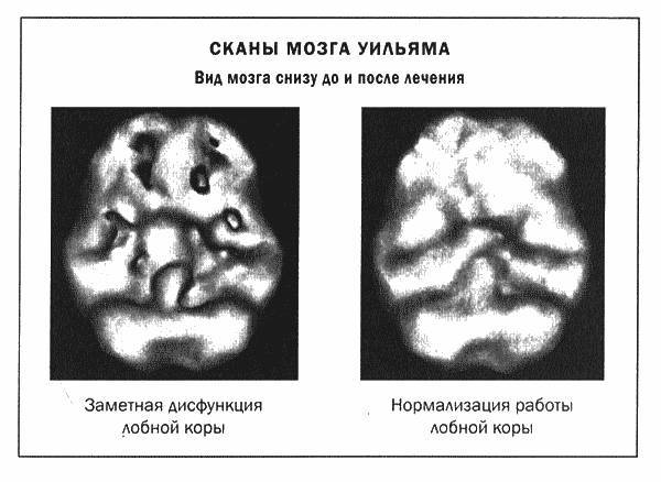 Мозг и душа _8.jpg