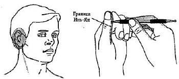 Пальцетерапия _65.jpg