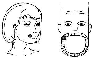 Пальцетерапия _69.jpg