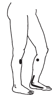 Китайский массаж гуаша _102.jpg