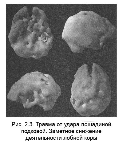 Измени мозг - изменится и тело _13.jpg