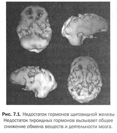 Измени мозг - изменится и тело _25.jpg