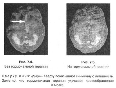 Измени мозг - изменится и тело _27.jpg