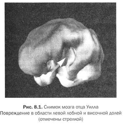 Измени мозг - изменится и тело _33.jpg