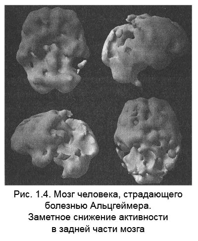 Измени мозг - изменится и тело _5.jpg