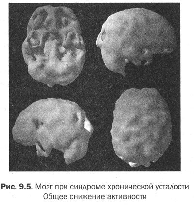 Измени мозг - изменится и тело _38.jpg